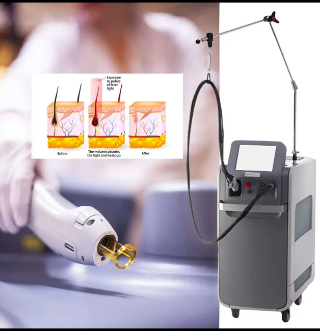 New CANDELA GentleMax Pro image 0