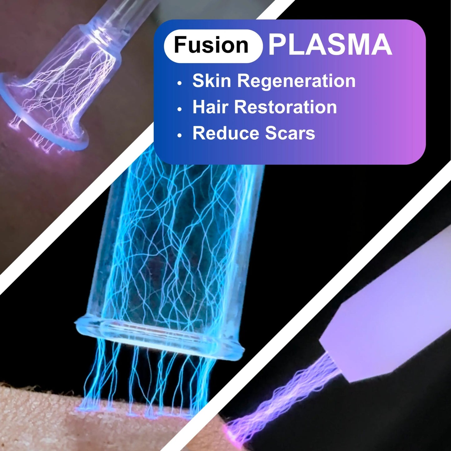 2025 Fusion Cold Warm Plasma image 4