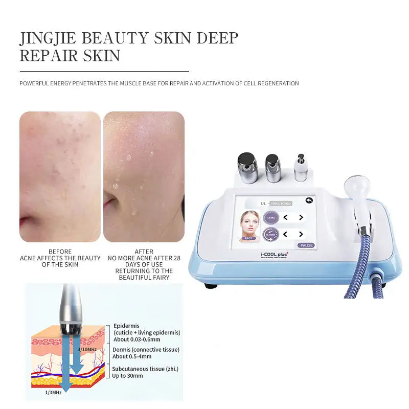 ICOOL PLUS SONIC ULTRASONIC PRODUCT PENERATION DEPTH Product