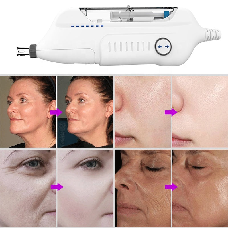 Facial Care Nutrition Face Lightening Rejuvenation Hy-Dra-Skinboosters Meso Gun image 4