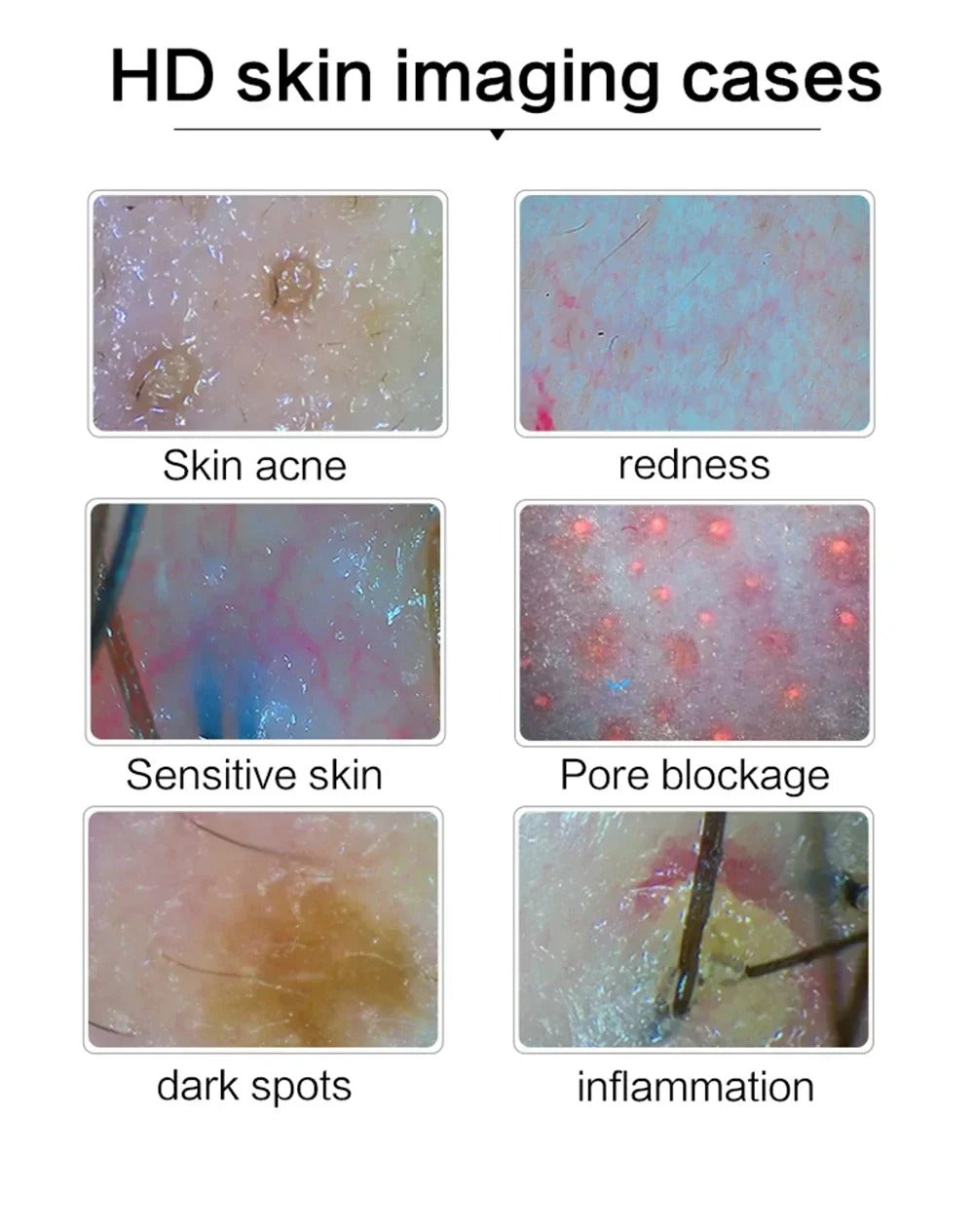 HD Digital Skin Analyzer Professional Hair Scalp Camera Detector Hair Follicle Oil Moisture Test Device 15inch Skin Tester