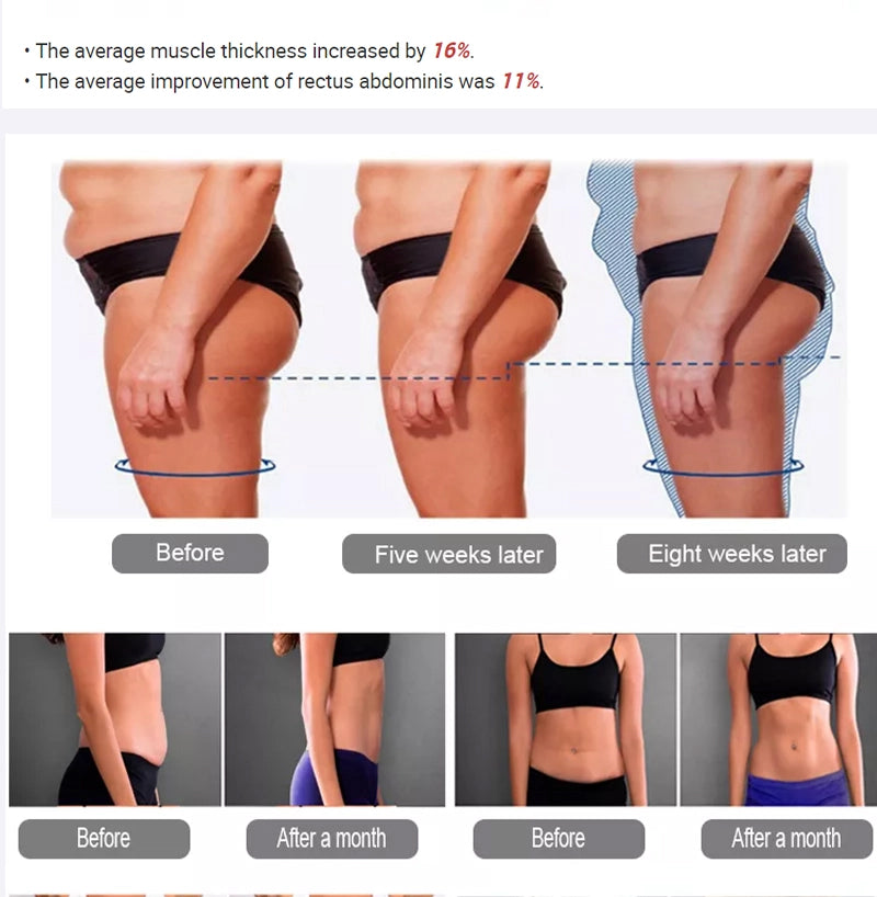 Portable 4 Handles EMS Body Sculpt Body Contouring Slimming Device image 4