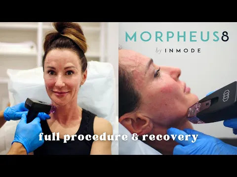 Portable 2 In 1 Morpheus8 Machine Skin Lifting Anti-aging Freckle Wrinkle Removal Acne Treatment Fractional Salon Use Device