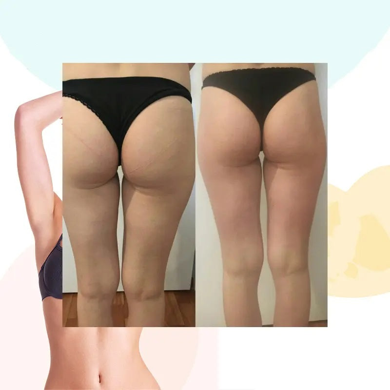 Body Slimming Contouring Cellulite Removal Machine Kuma Shape Pro
