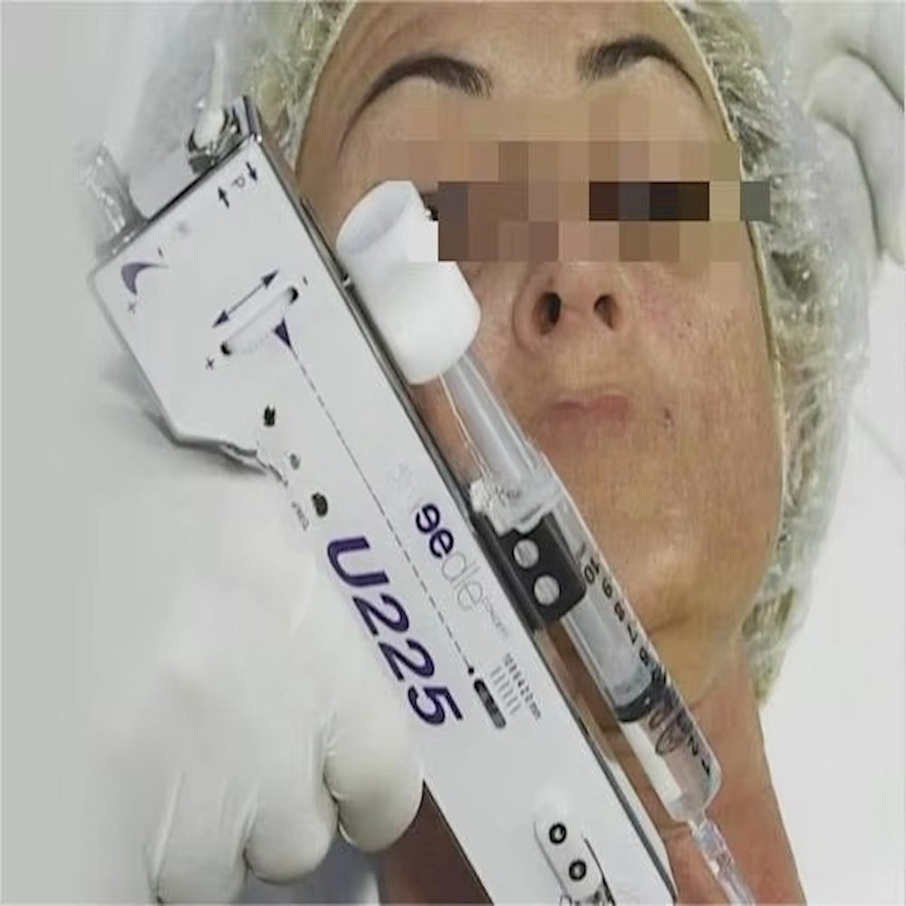 Mesotherapy Gun Needle Injection Gun Prp Mesotherapy Injection Gun Needleless Anti-aging Nano Crystal U225meso
